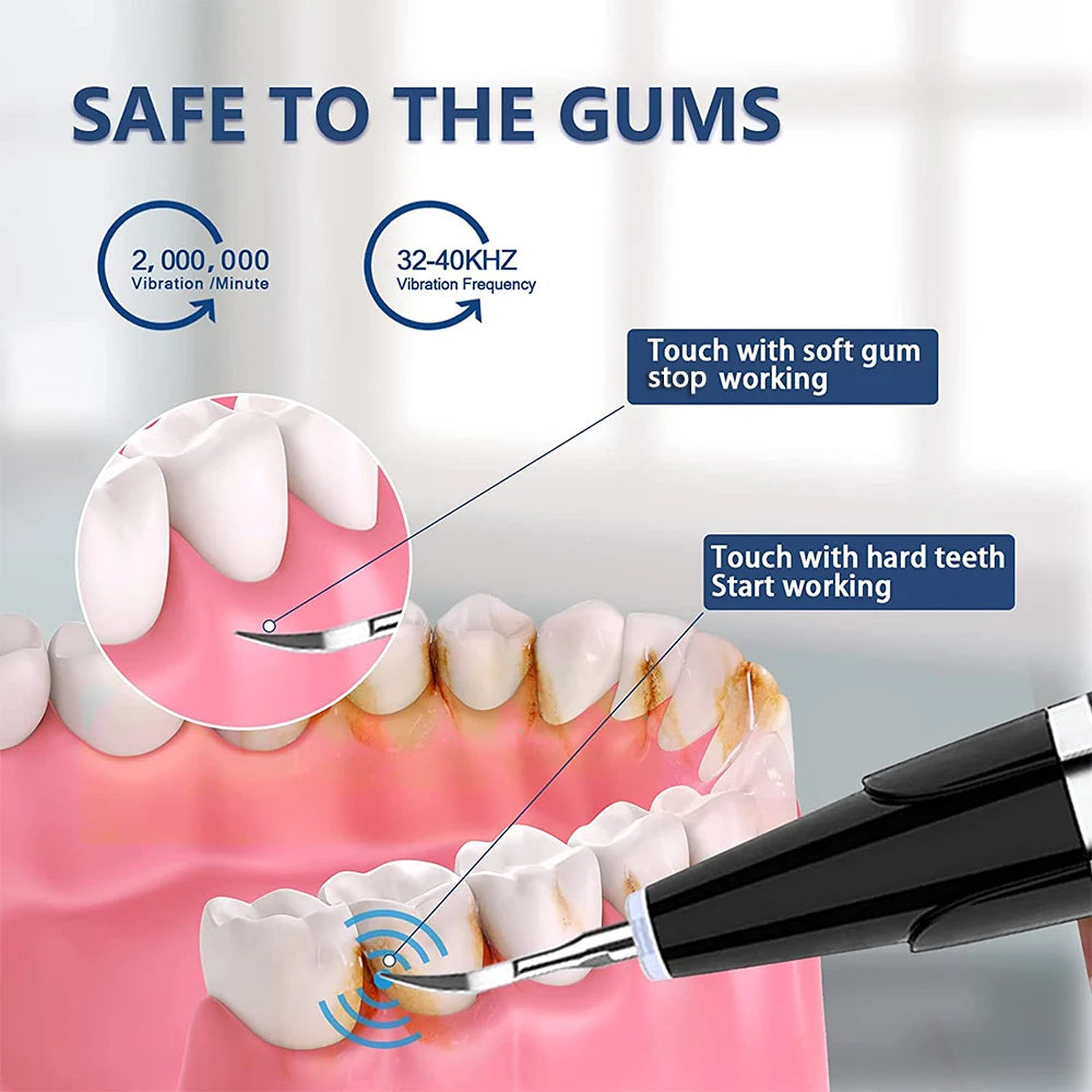 Sbiancamento dei denti sonico pulizia dei denti elettrici ablatori Ultra sonici per la pulizia delle macchie della placca dei denti tartaro dentale rimozione del tartaro